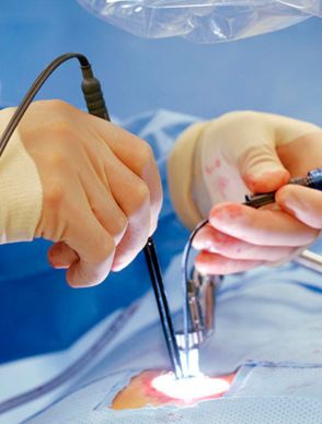 Endoscopic Surgeon in Hyderabad