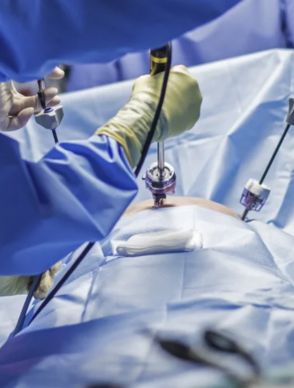 Minimally Invasive Surgery in Hyderabad