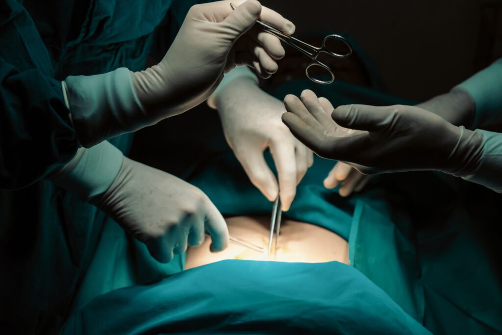 best abdominal surgeon in madhapur